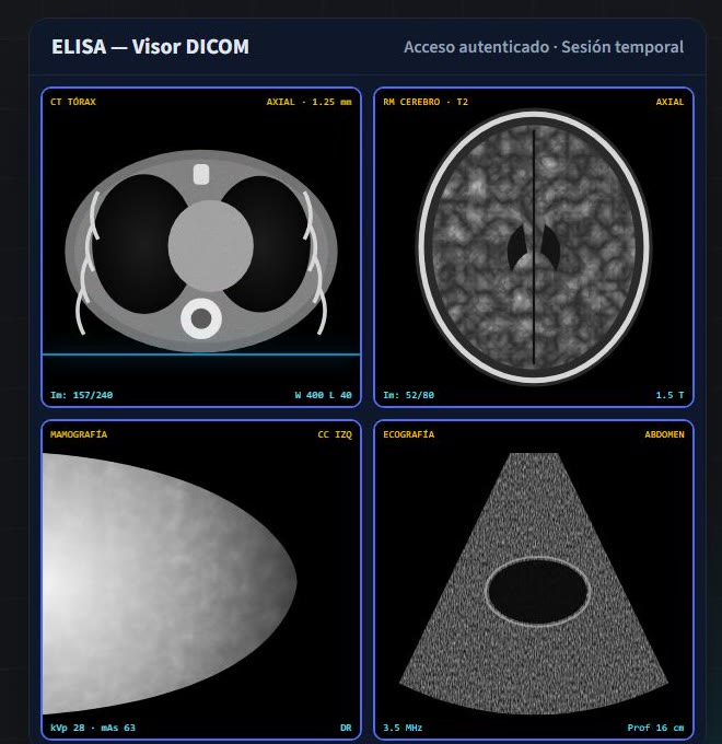 Visor DICOM con cuatro estudios: tomografía de tórax, resonancia de cerebro, mamografía y ecografía